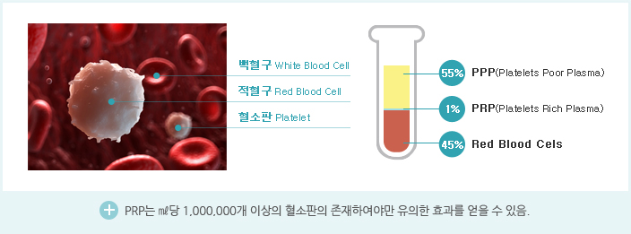 PRP Therapy 설명이미지