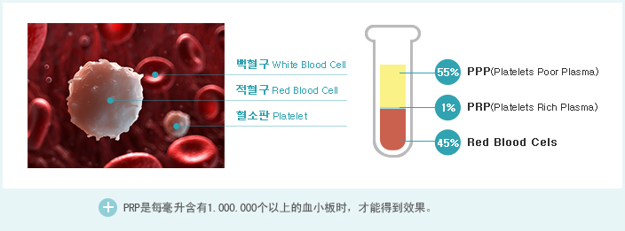 PRP Therapy 설명이미지
