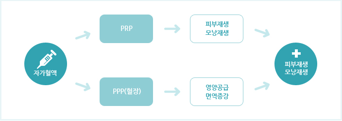 PRP 치료의 효과 설명이미지