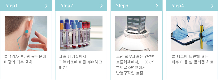 Step1 - 혈액검사 후, 귀 뒷부분에 미량의 피부 채취 > Step2 - 세포 배양실에서 피부세포에 ID를 부여하고 배양 > Step3 - 보관 피부세포는 안전한 보존체제에서, -196℃의 액체질소탱크에서 반영구적인 보존 > Step4 - 셀 뱅크에 보관해 놓은 피부 이용 셀 콜라겐 치료